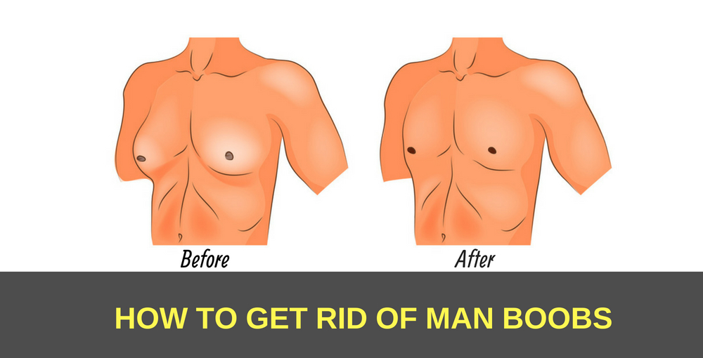 Getting Rid Of Man Boobs In Los Angeles